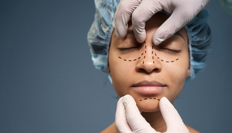 Rhinoplasty: Redefine Your Profile with Confidence and Care